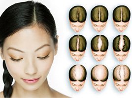 PRP FOR HAIR RESTORATION